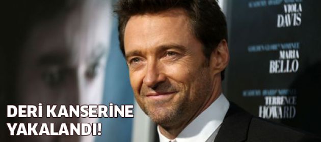 Ünlü aktör kansere yakalandı
